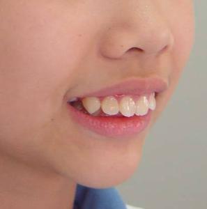 牙齿长得好的女人面相 自古以来，相书上说有记载：牙齿长得好的