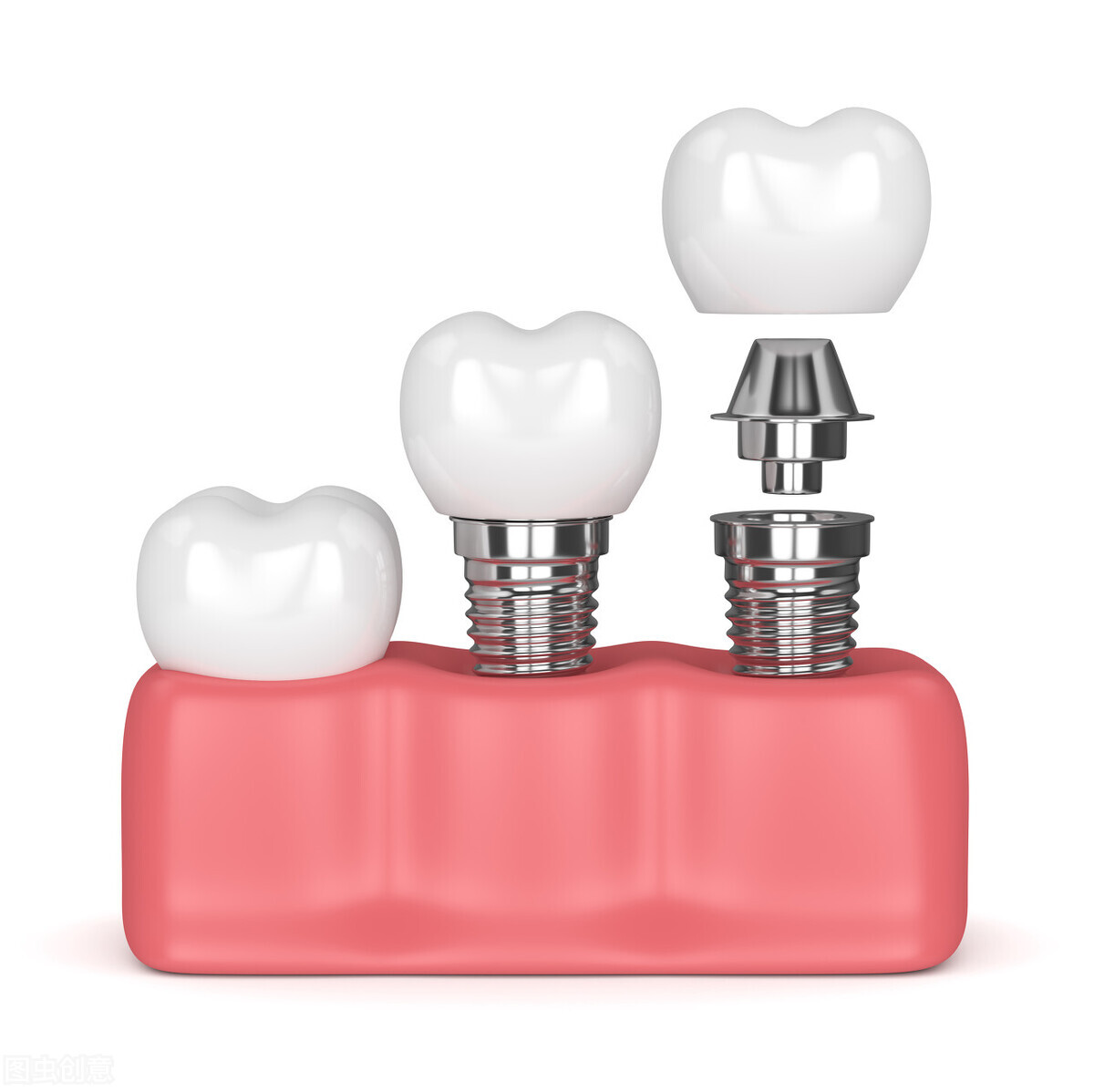 缺牙者平均寿命比牙齿健全者短10~20年